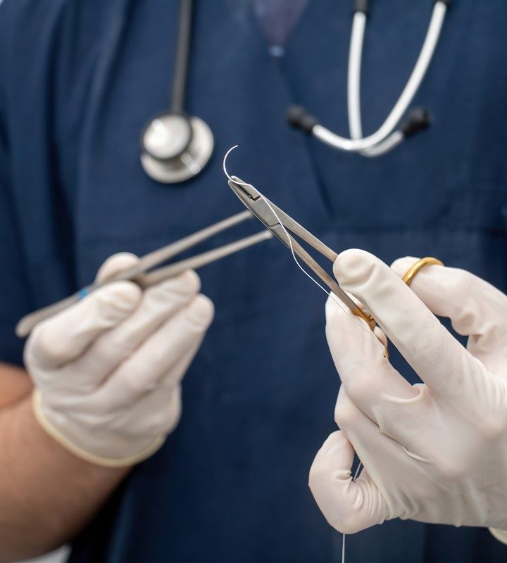 Set de sutures biodégradables : vers une chirurgie plus respectueuse de l’environnement