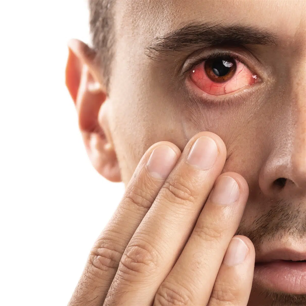 apaiser les yeux rouges