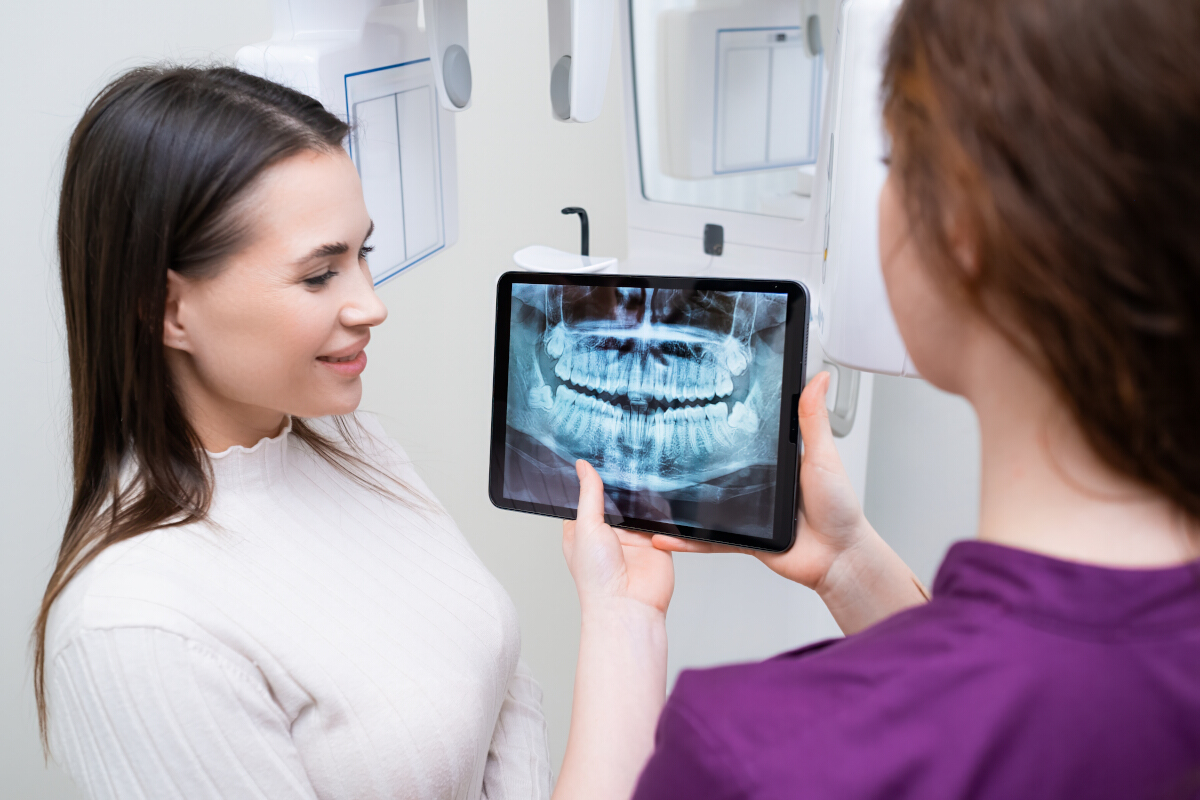 questions sur implants dentaires